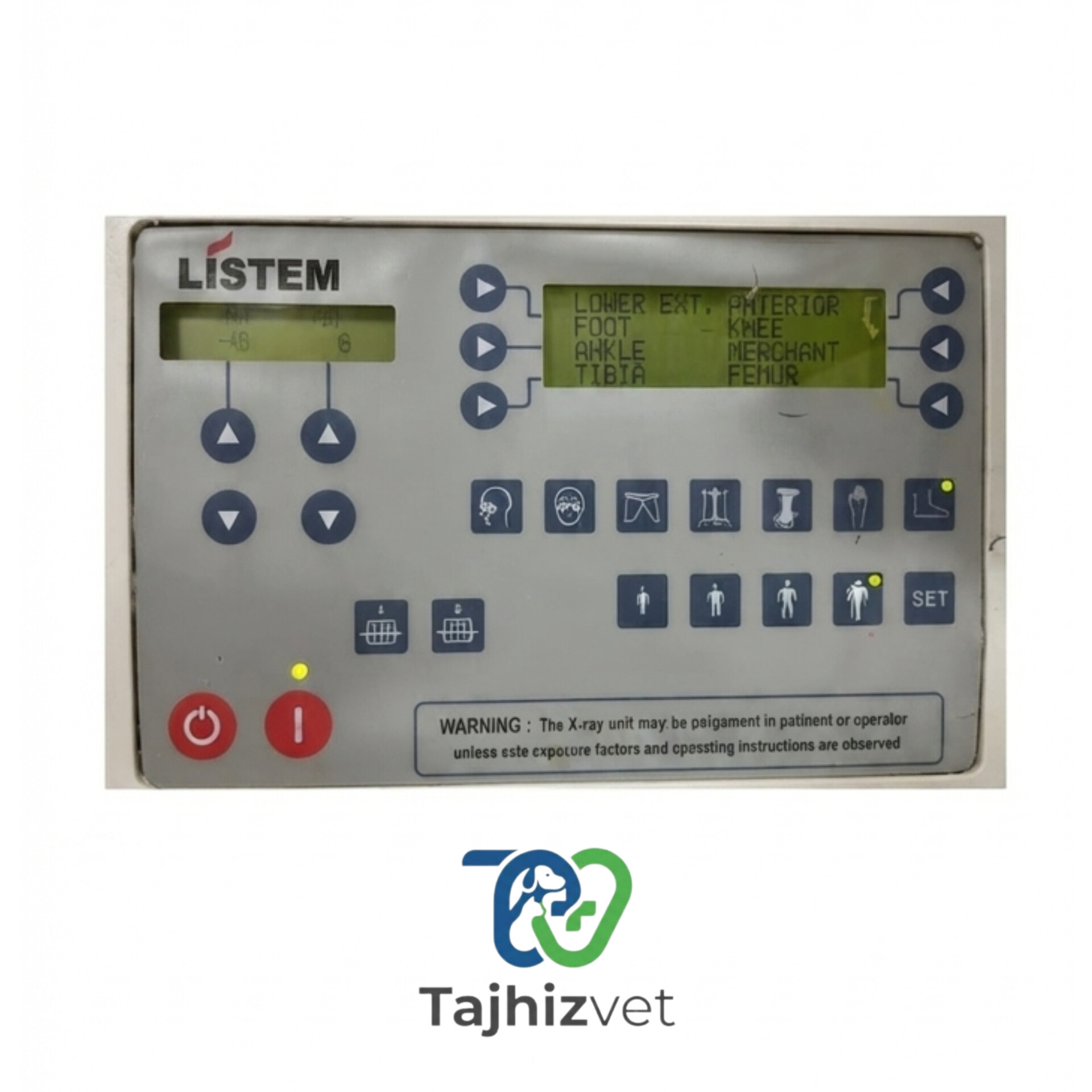 دستگاه رادیولوژی موبایل LISTEM