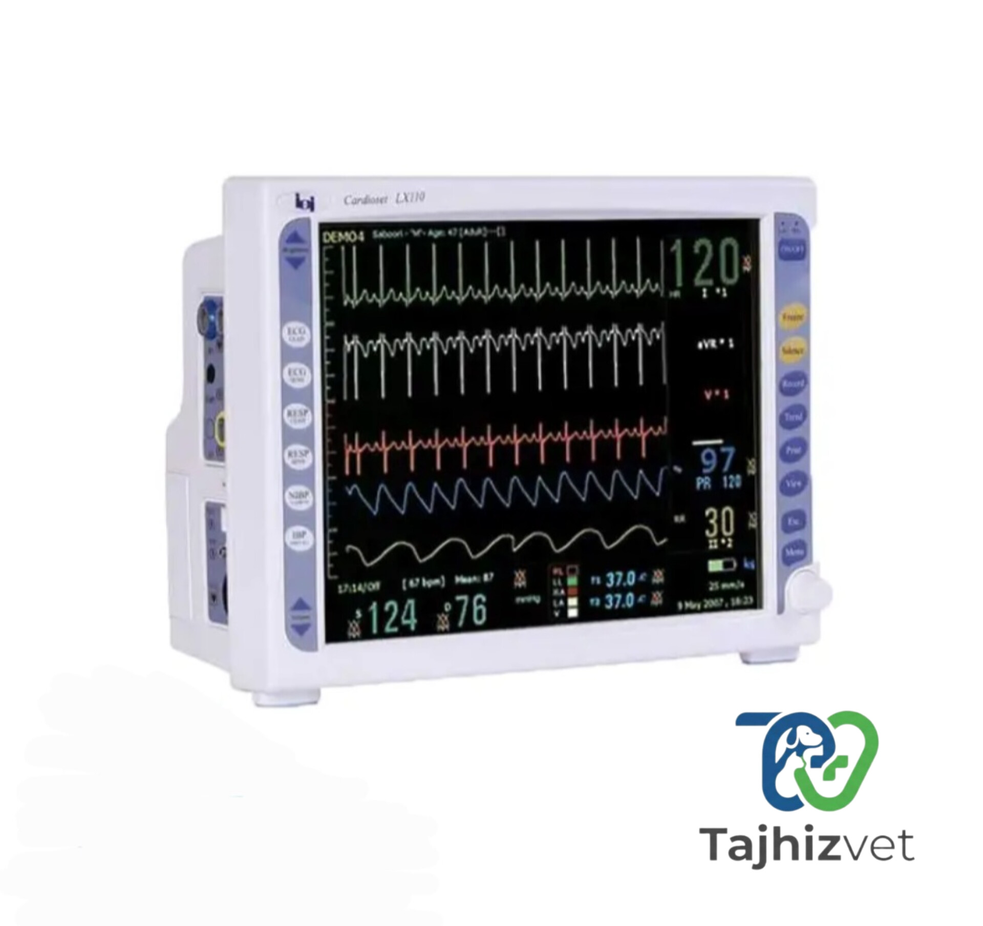 مانیتور علائم حیاتی CARDIOSET LX110